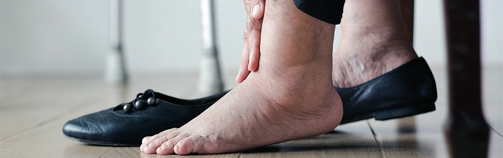 swollen feet diabetes