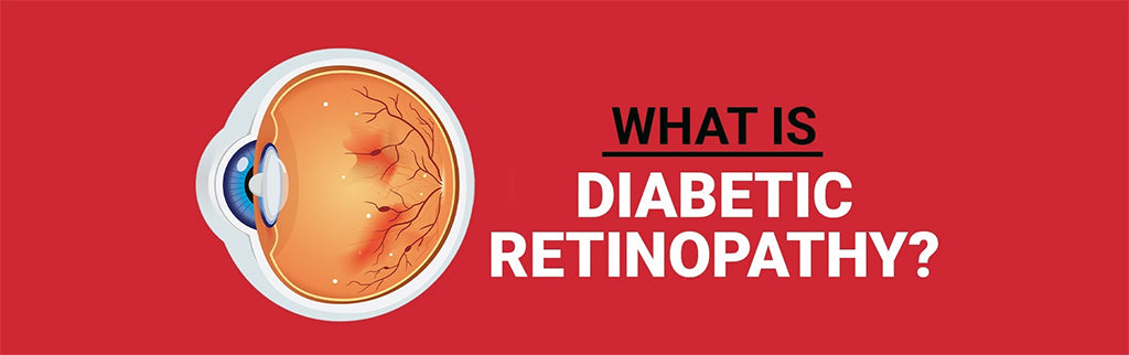 What is Diabetic Retinopathy