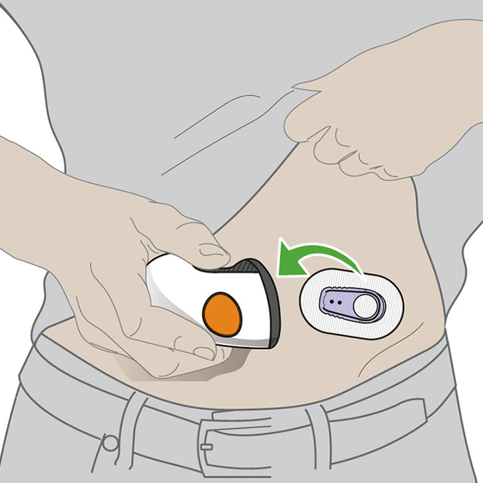Dexom Sensor Application DexCom G6 Sensors (3-Pack)